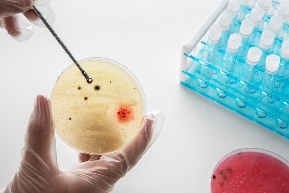 Bone Marrow and Stem Cell Transplantation Overview