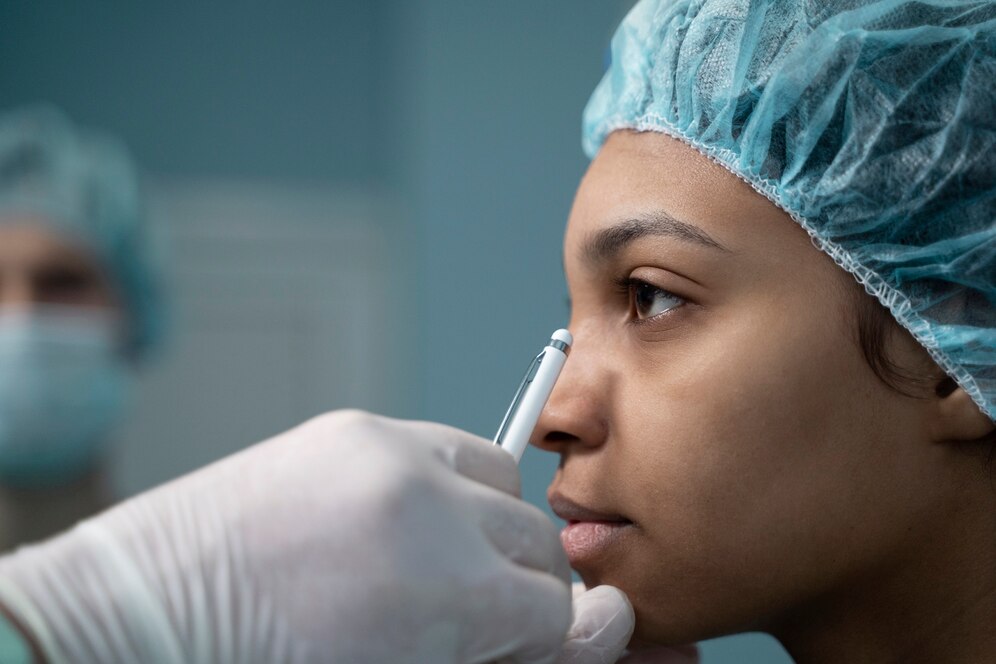 Rhinoplasty: A Comprehensive Overview