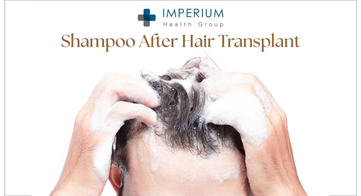 Best Shampoo After Hair Transplant: Safe & Effective Hair Care