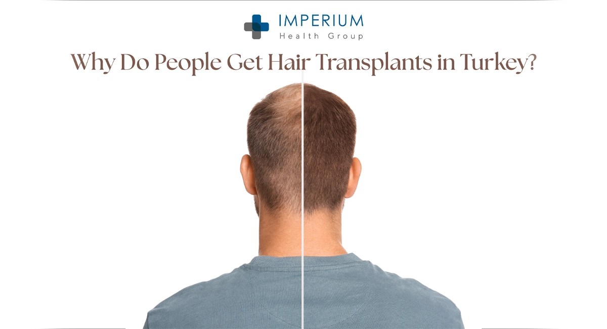 Why Do People Get Hair Transplants in Turkey: Learn About Costs, Results, Risks