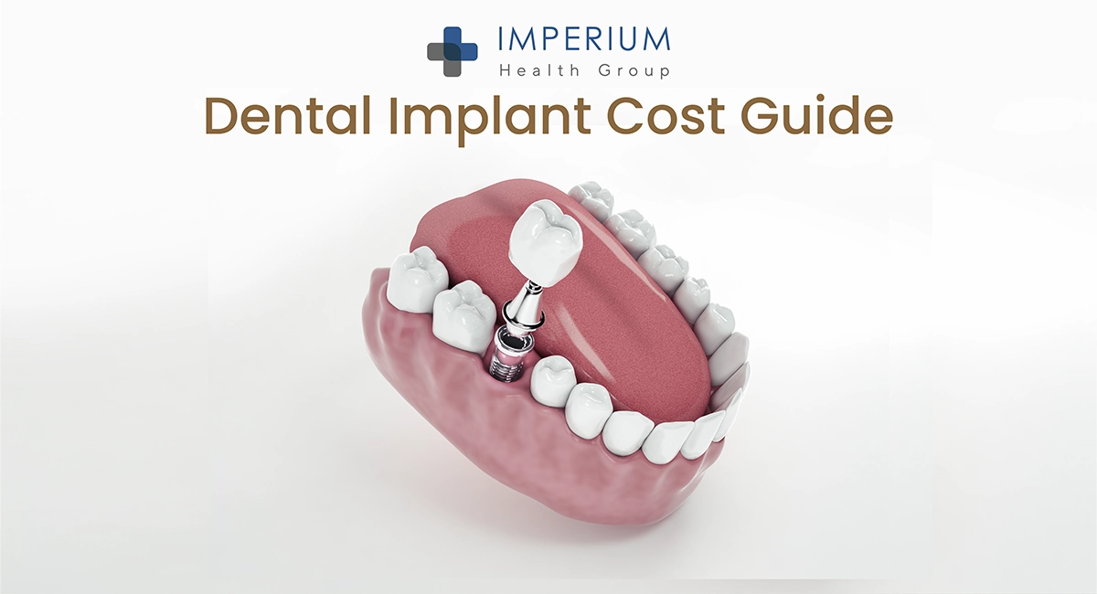 Complete Cost Guide for Dental Implants in 2026
